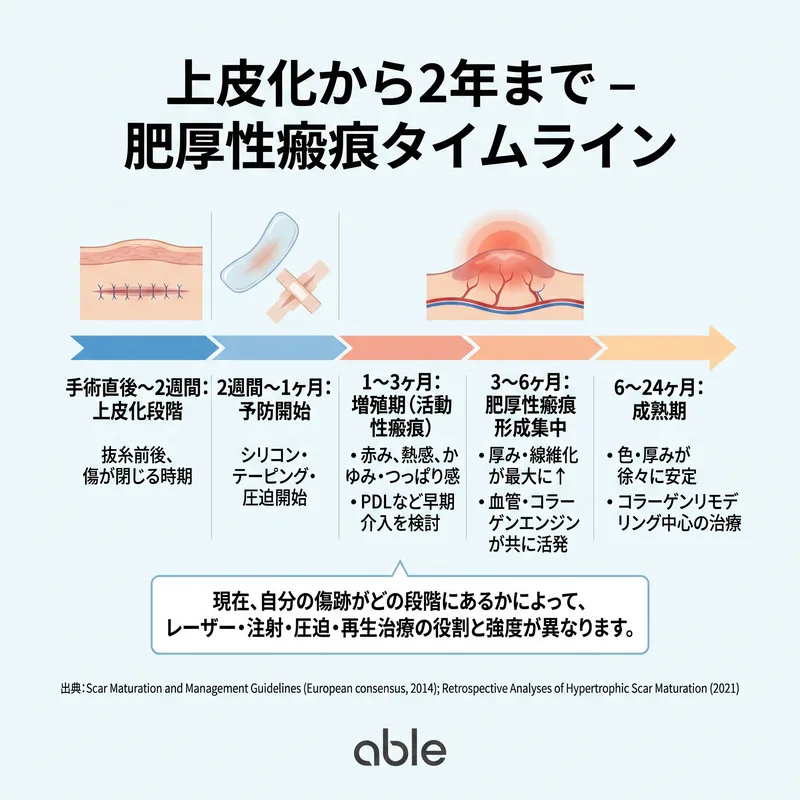 上皮化から2年までの肥厚性瘢痕成熟タイムライン