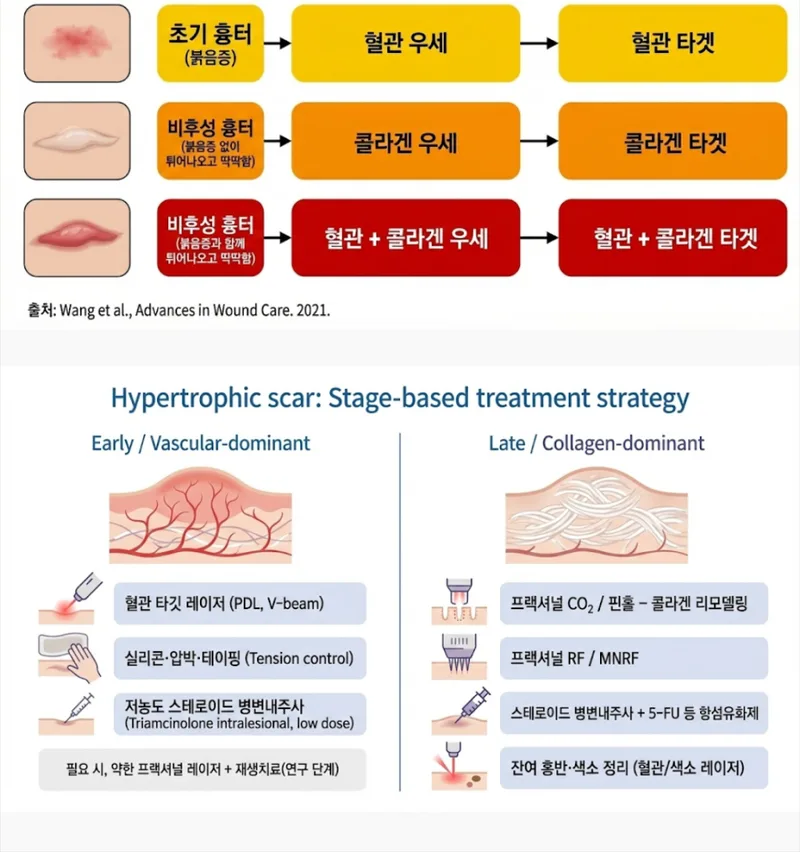 흉터 유형별 치료 전략 — 초기 혈관 우세 vs 후기 콜라겐 우세 단계별 치료법 인포그래픽