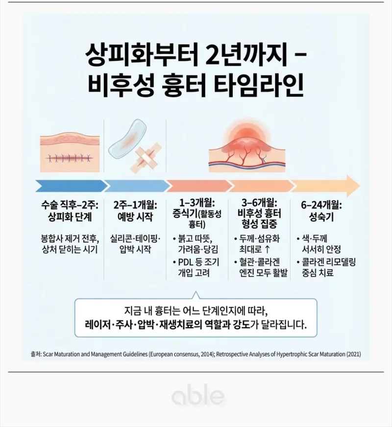 상피화부터 2년까지 비후성 흉터 타임라인 — 단계별 예방 및 치료 시기 안내
