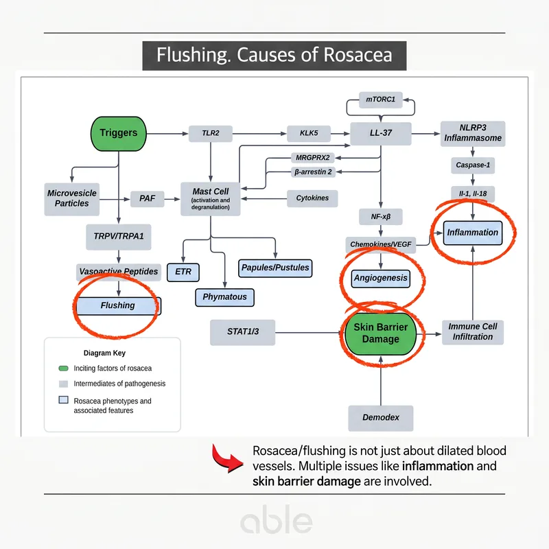 Rosacea pathogenesis diagram — vascular dilation, inflammation, and skin barrier dysfunction as combined mechanisms