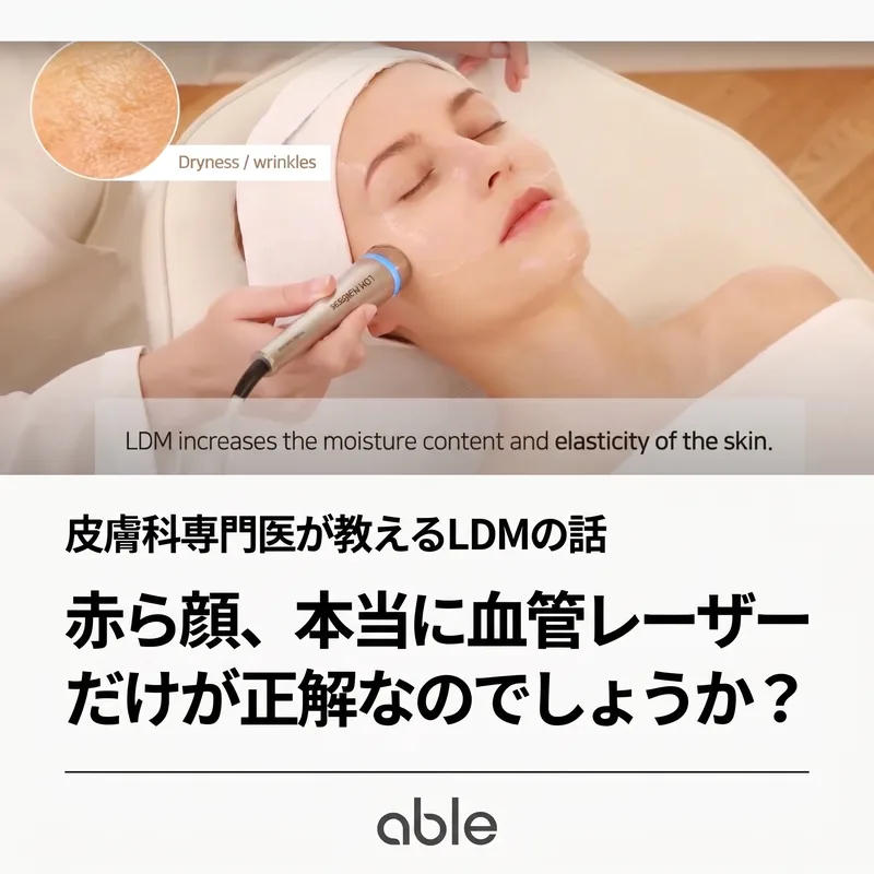 LDM低周波超音波施術 — ハンドピースで顔に水分と弾力を伝達する場面