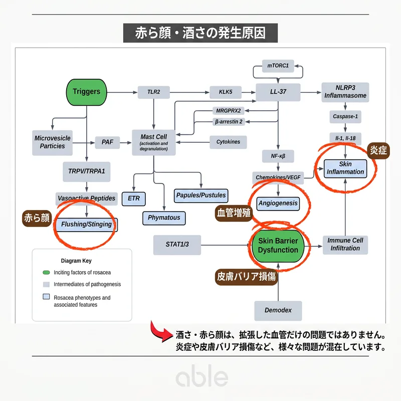 酒さの病因図 — 血管拡張、炎症、皮膚バリア機能障害の複合メカニズム