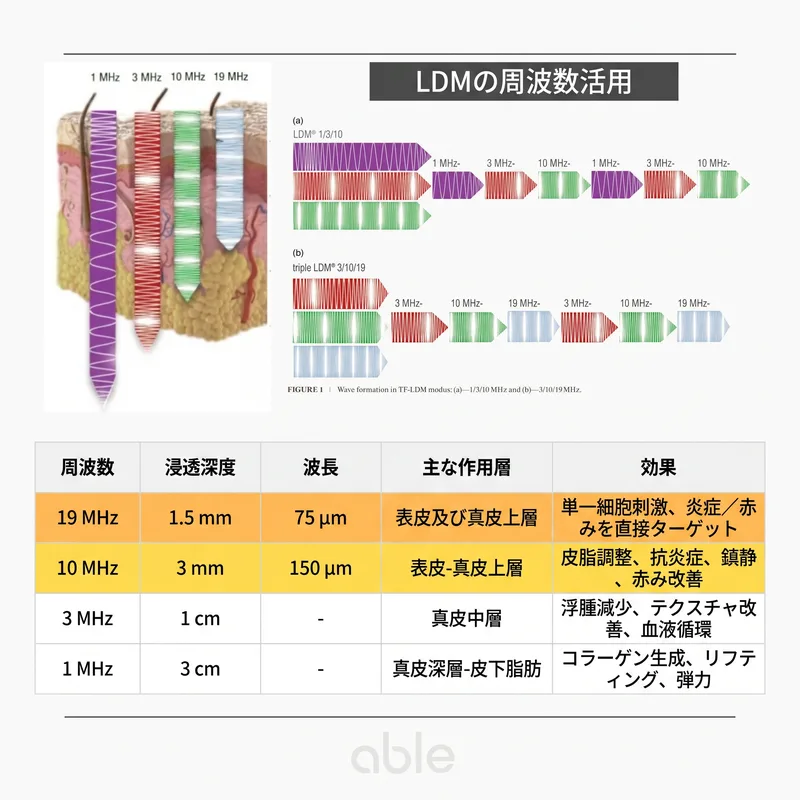 LDM周波数別浸透深度と作用層の比較表 — 1MHzから19MHzまでの効果の違い