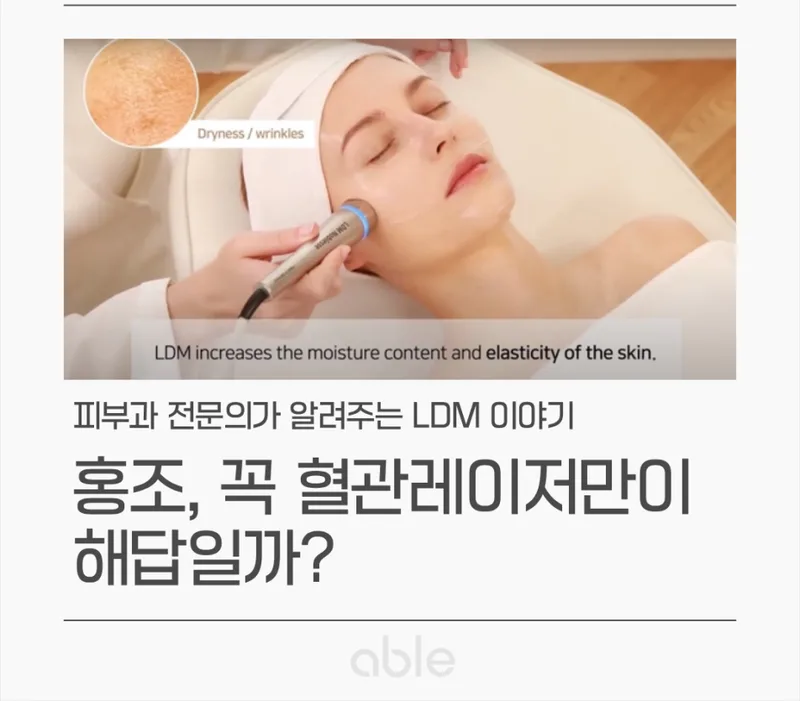 LDM 저주파 초음파 시술 장면 — 핸드피스로 얼굴에 수분과 탄력을 전달하는 모습