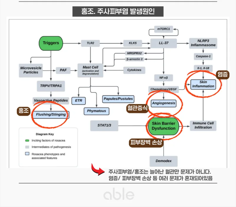 홍조와 주사피부염의 발생 원인 도식 — 혈관 확장, 염증, 피부장벽 손상의 복합 기전