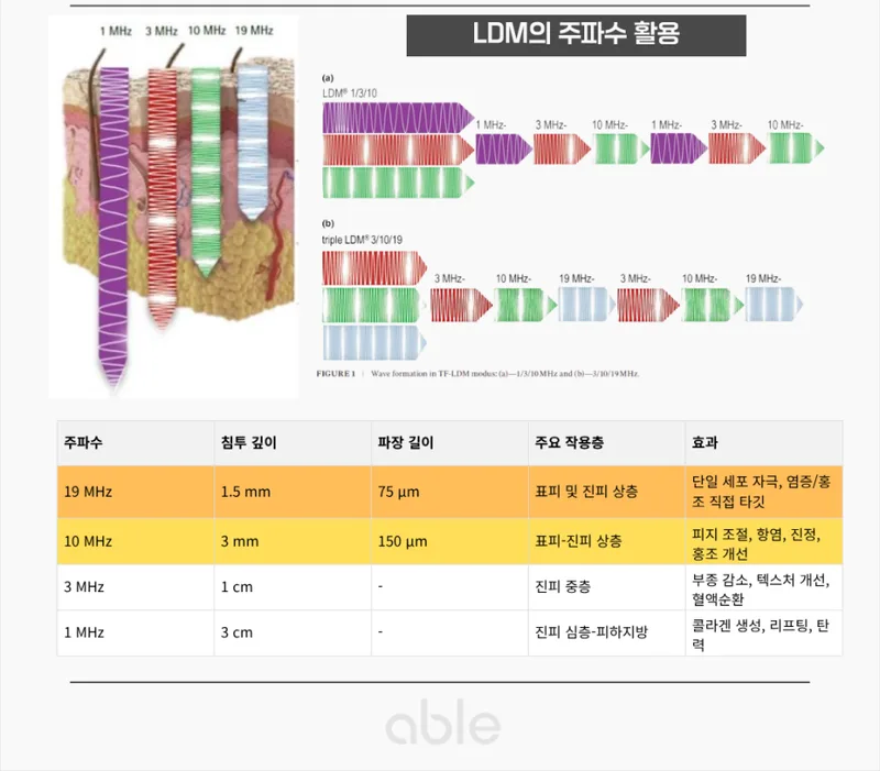 LDM 주파수별 침투 깊이와 작용층 비교표 — 1MHz에서 19MHz까지의 효과 차이