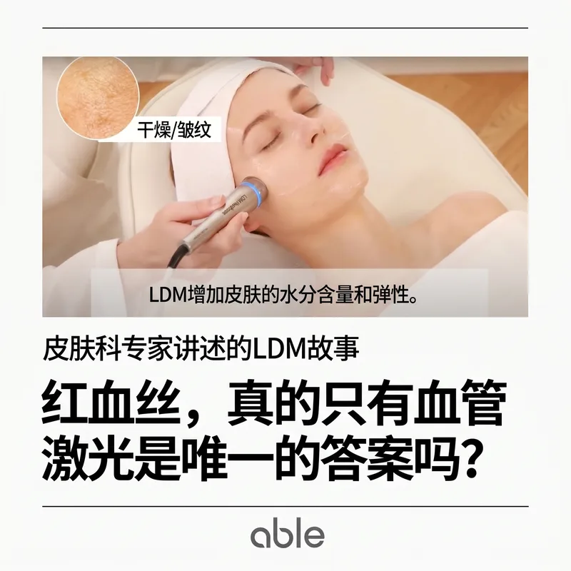 LDM低频超声治疗 — 手柄向面部传递水分和弹性