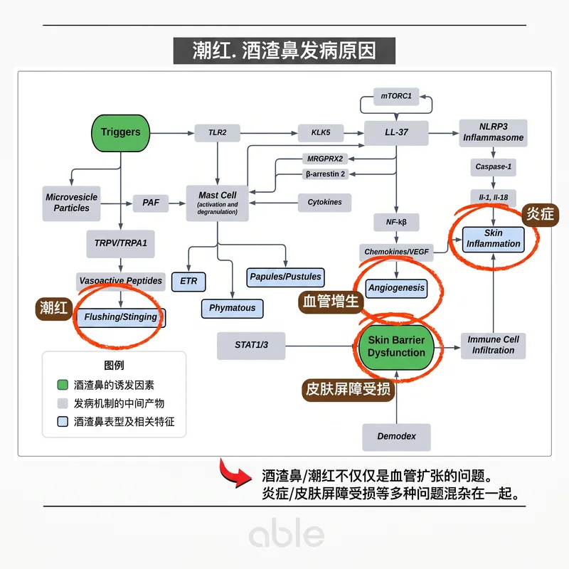 酒糟鼻发病机制图 — 血管扩张、炎症和皮肤屏障功能障碍作为综合机制