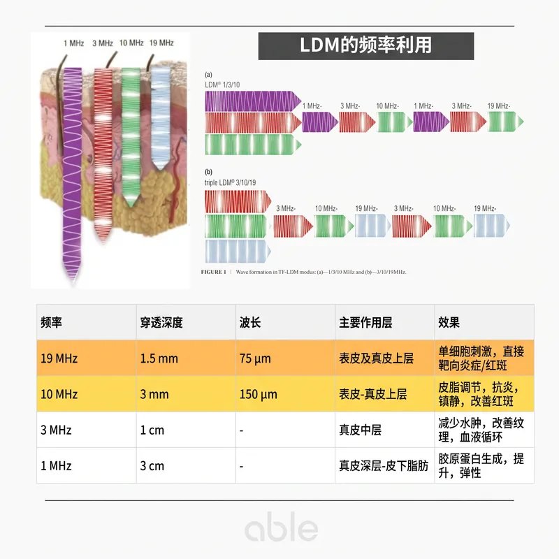 LDM频率穿透深度比较表 — 1MHz到19MHz在不同皮肤层的效果