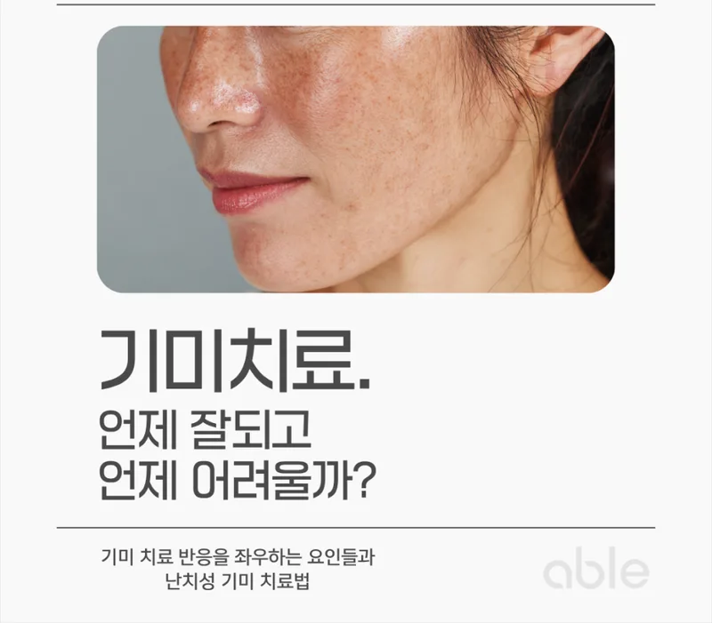 기미 치료 반응 차이 — 잘 되는 기미와 어려운 기미를 구분하는 요인 인포그래픽