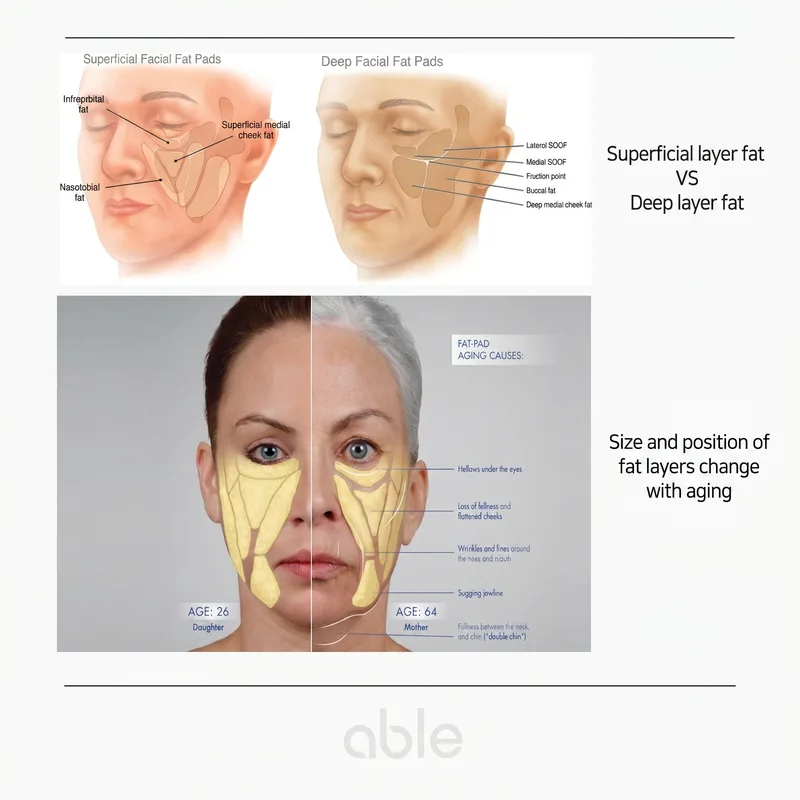 Superficial vs deep facial fat compartments — distribution and age-related changes