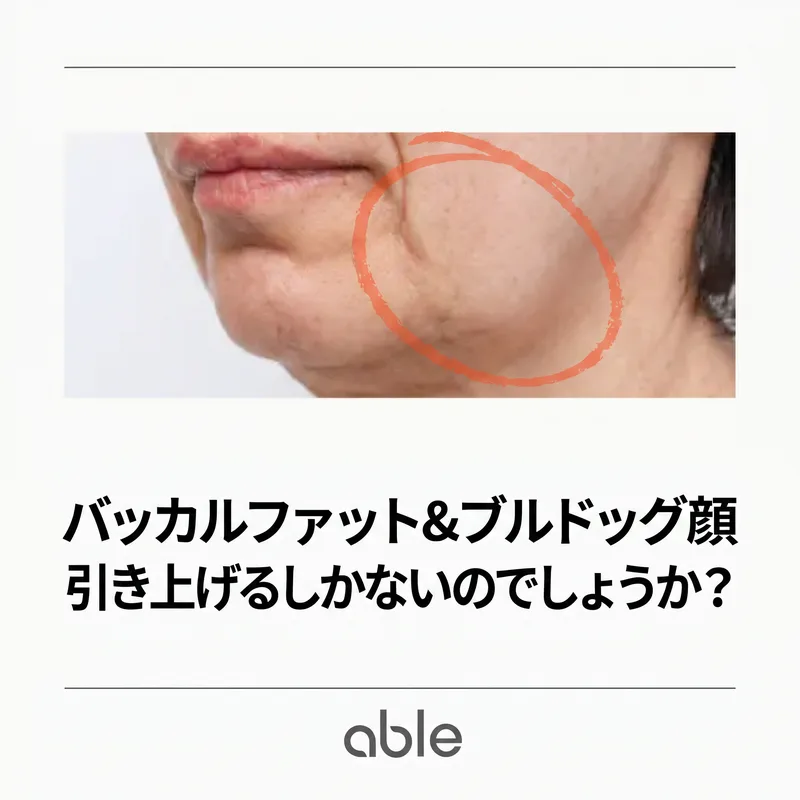 深部頬・jowlsの下垂した顔の側面 — 引き上げではなく「埋める」アプローチが必要な構造的たるみ