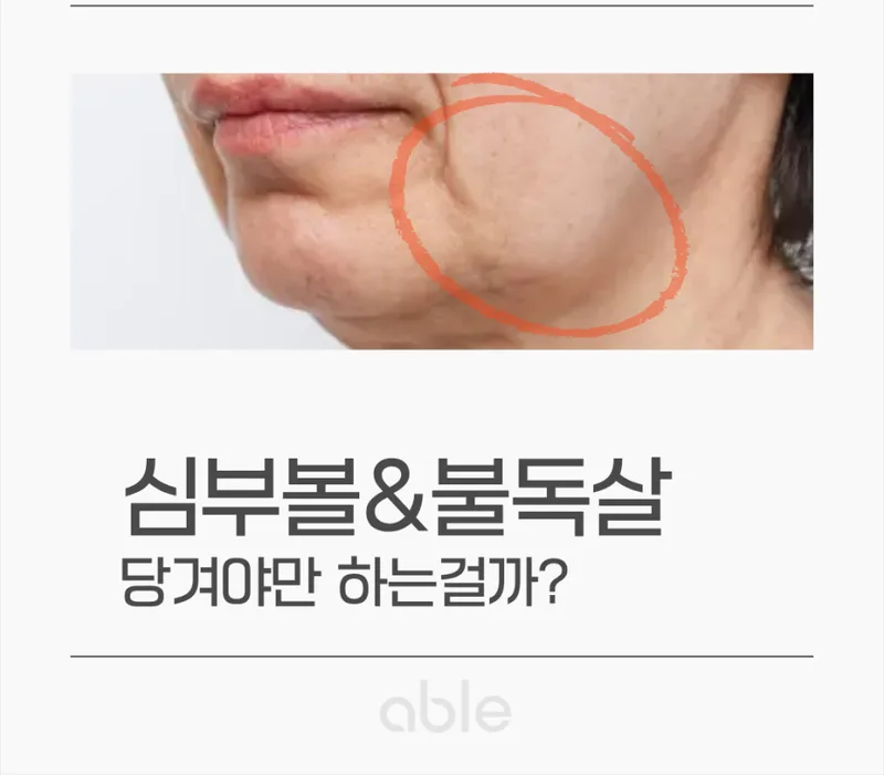 심부볼·불독살(jowls)이 처진 얼굴 측면 — 마리오넷 라인과 turkey neck 진행