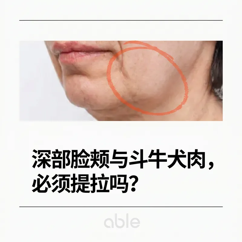 深层颊·下颌赘肉(jowls)下垂的面部侧视图 — 需要
