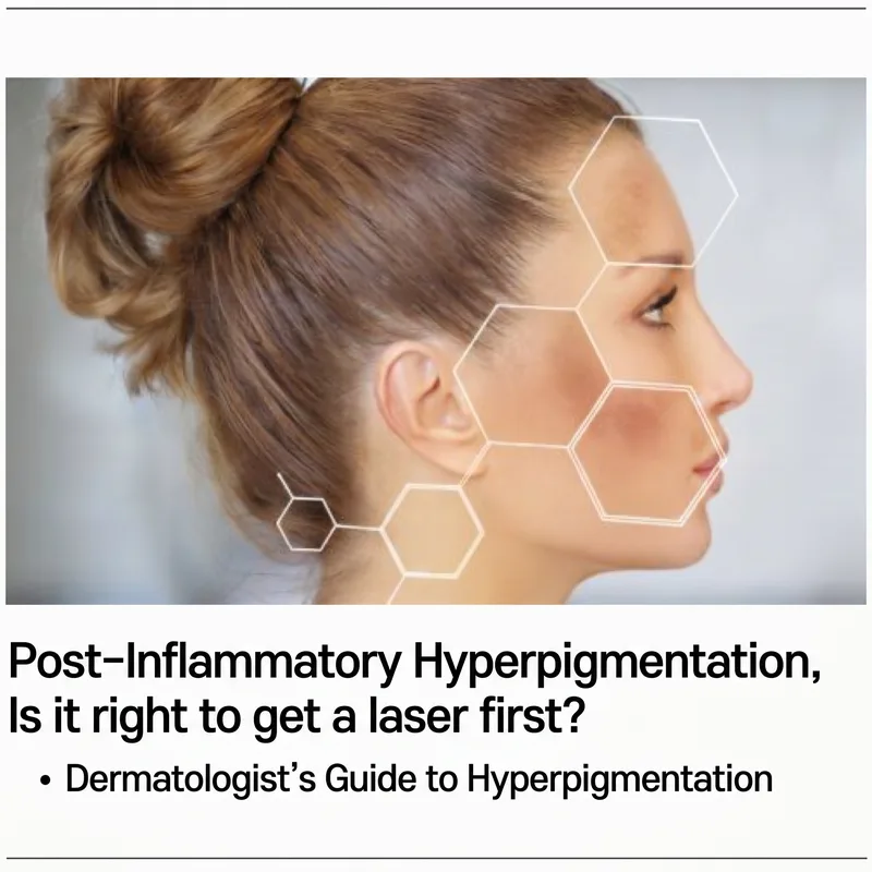 Woman profile with skin cell structure overlay — PIH treatment guide