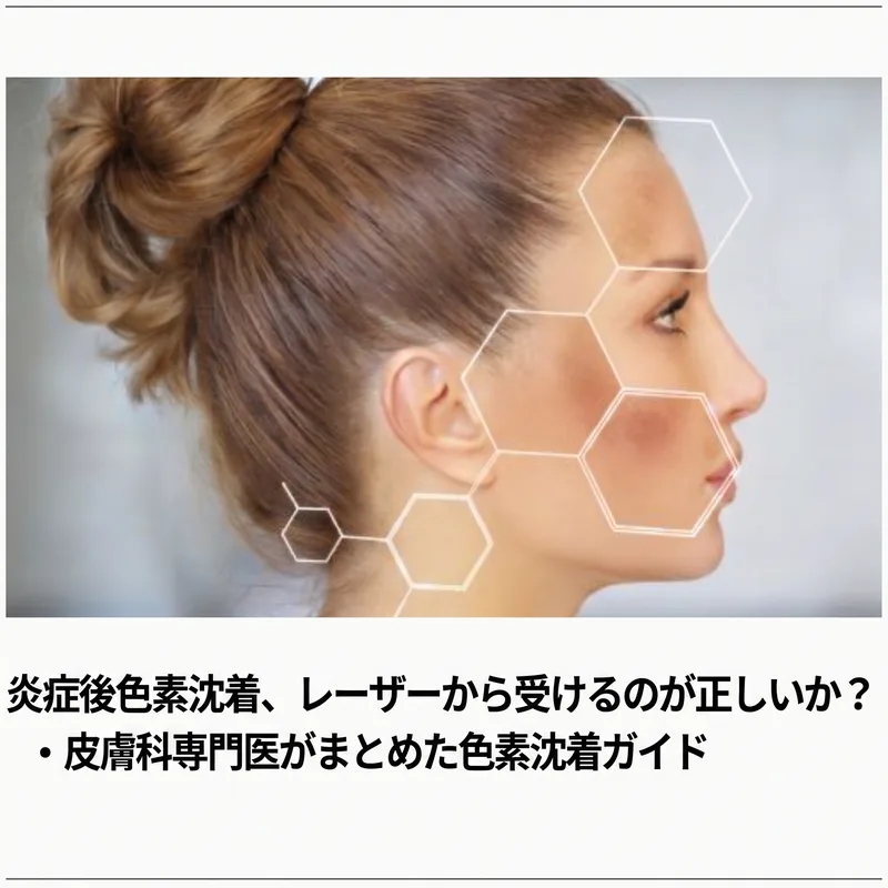 女性の横顔と皮膚細胞構造オーバーレイ — PIH治療ガイド