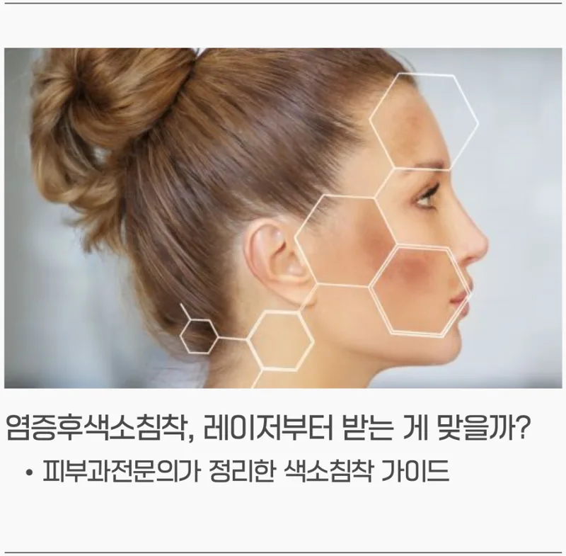 여성 얼굴 측면과 피부 세포 구조 오버레이 — 염증후 색소침착 가이드