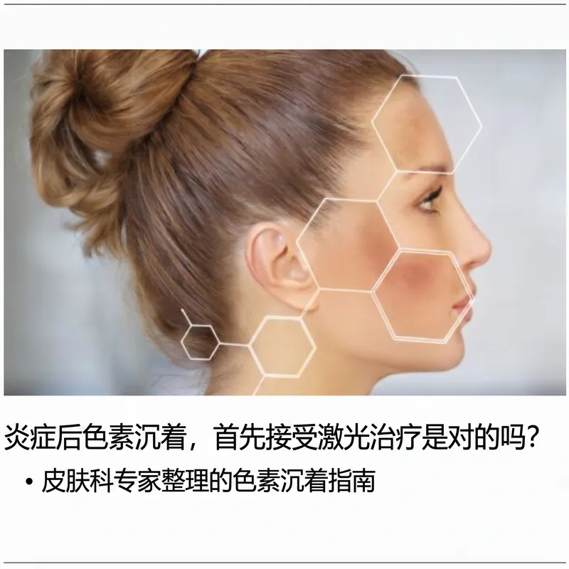 女性侧面轮廓与皮肤细胞结构叠加 — PIH治疗指南