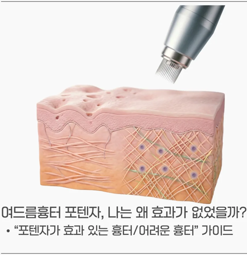 포텐자 니들RF 핸드피스가 피부 단면에 에너지를 전달하는 3D 일러스트