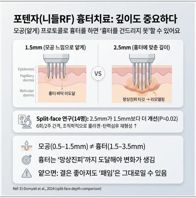포텐자 니들RF 깊이별 효과 비교 — 1.5mm(모공) vs 2.5mm(흉터) 치료 깊이 차이