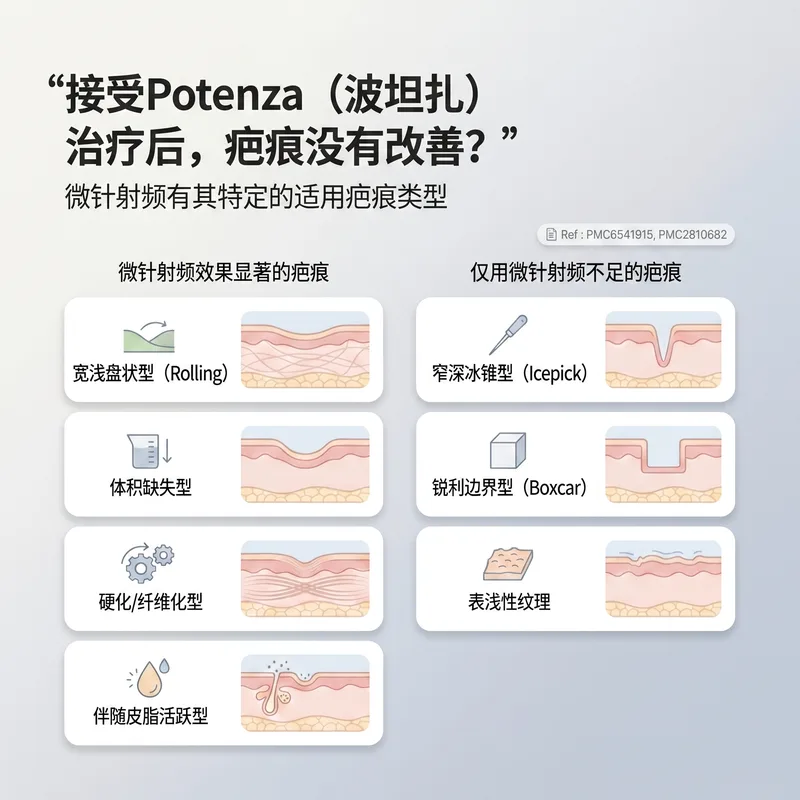 对微针射频有反应的疤痕类型与效果有限的疤痕类型对比