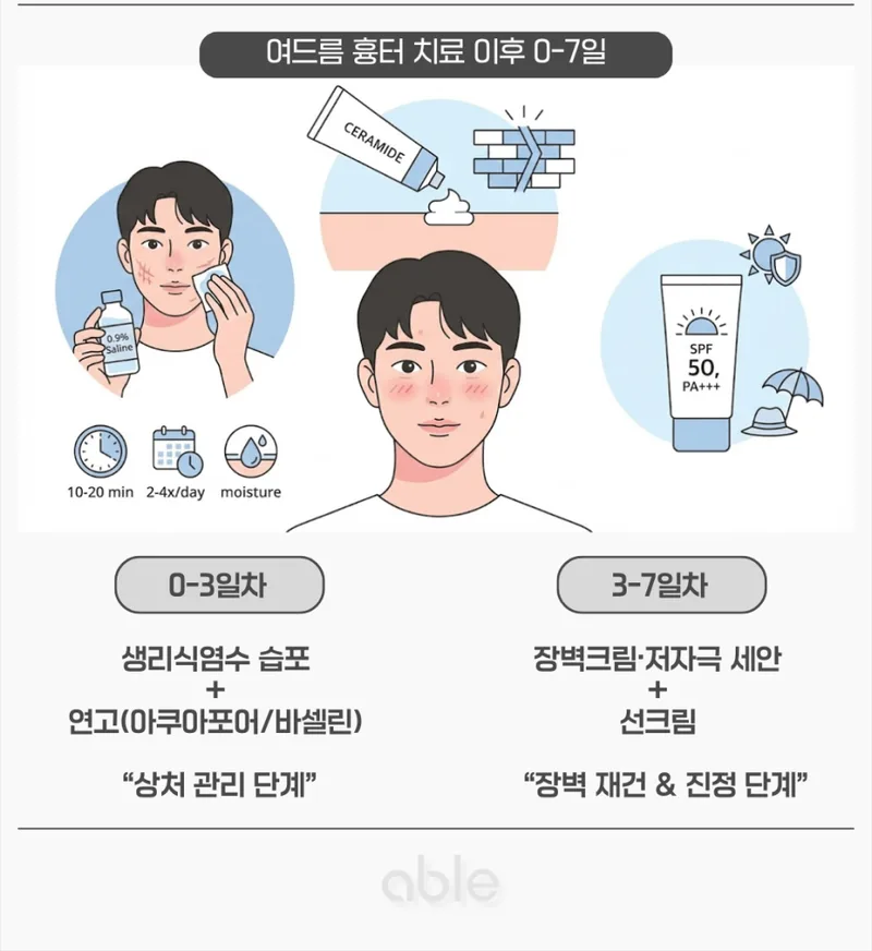 여드름 흉터 치료 후 0~7일 급성기 스킨케어 가이드: 생리식염수 습포와 장벽크림 단계