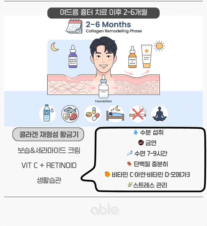 여드름 흉터 치료 후 2~6개월 콜라겐 재형성기 스킨케어와 생활습관 가이드