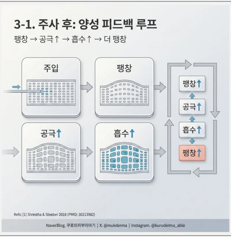 스킨부스터 주사 후 양성 피드백 루프 — 팽창·공극·흡수 순환 다이어그램