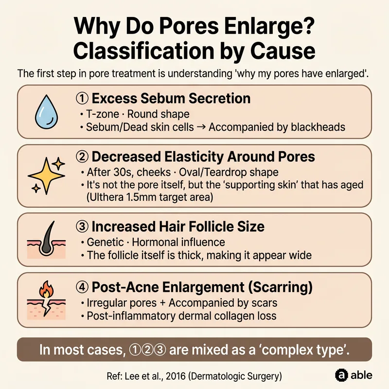 Three causes of enlarged pores: excess sebum, elasticity loss, scar type comparison illustration
