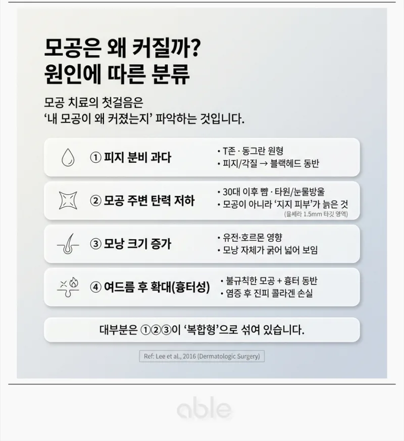 모공 확대의 세 가지 원인: 피지 과다, 탄력 저하, 흉터 유형별 비교 일러스트