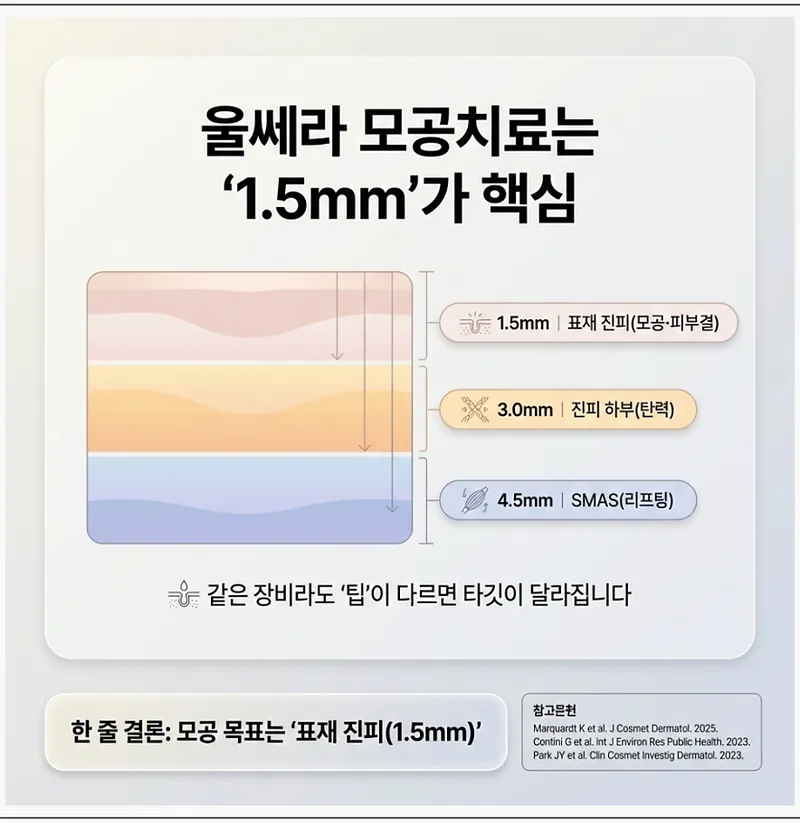 울쎄라 다층 접근: 1.5mm, 3.0mm, 4.5mm 팁의 피부층별 작용 깊이 비교