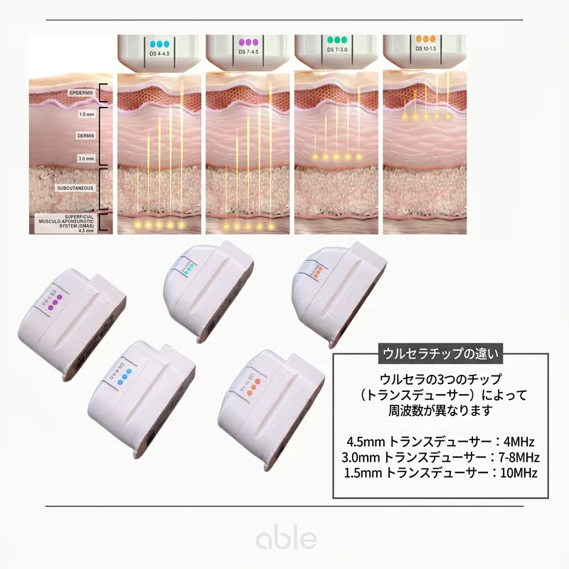 ウルセラTCP（熱凝固点）形成原理と熱勾配図