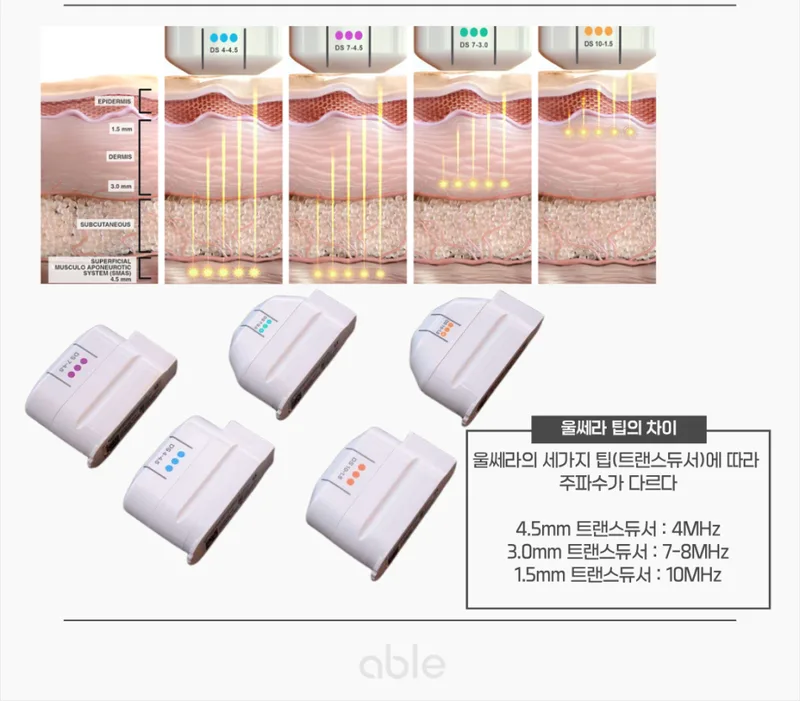 울쎄라 TCP(열응고점) 형성 원리와 열경사대 다이어그램