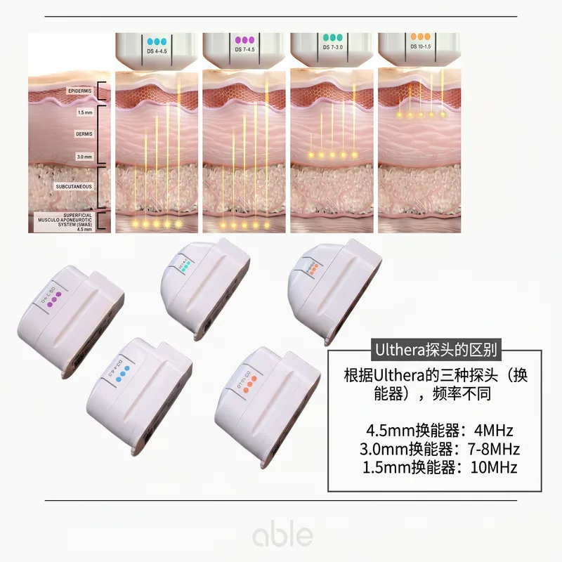 Ulthera TCP（热凝固点）形成原理和热梯度图
