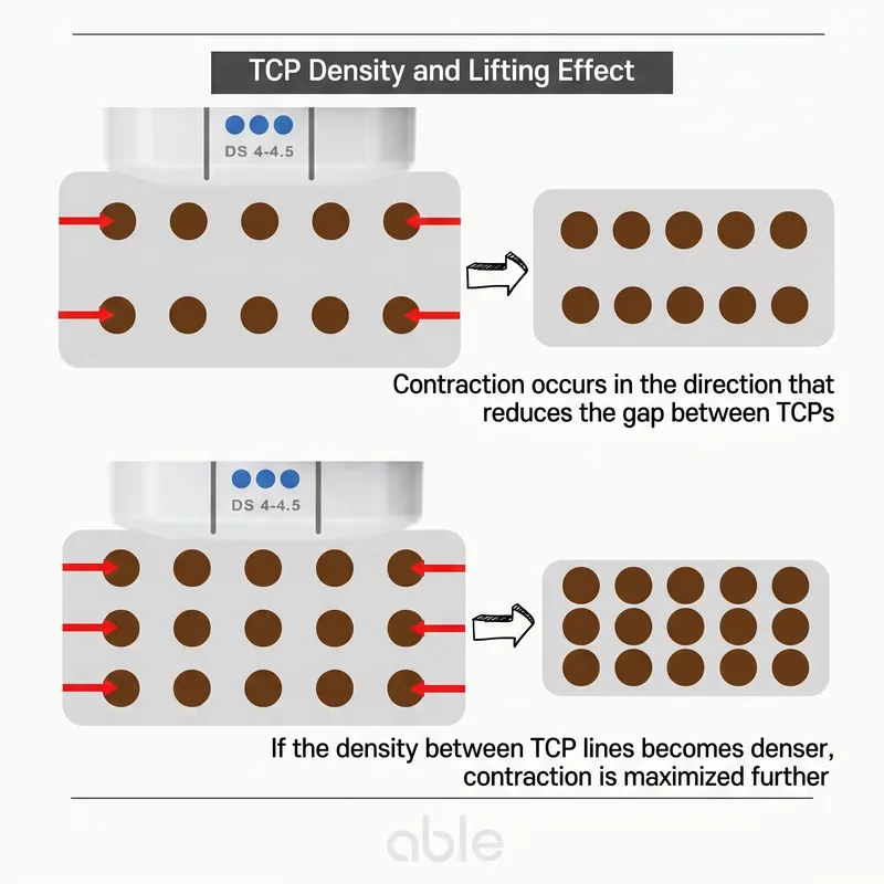 Diagram showing TCP density and lifting effect — closer coagulation points produce stronger tissue contraction