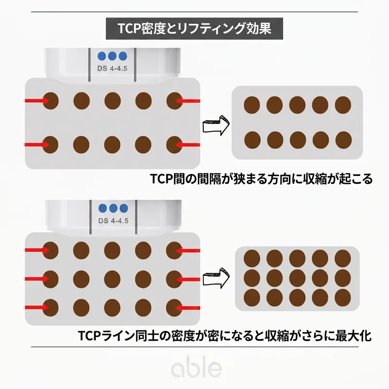 TCP密度とリフティング効果の関係を示す図解 — 凝固点の間隔が狭いほど収縮効果が増大