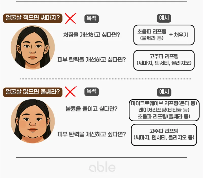 얼굴살 적은 경우와 많은 경우의 리프팅 시술 선택 가이드 인포그래픽